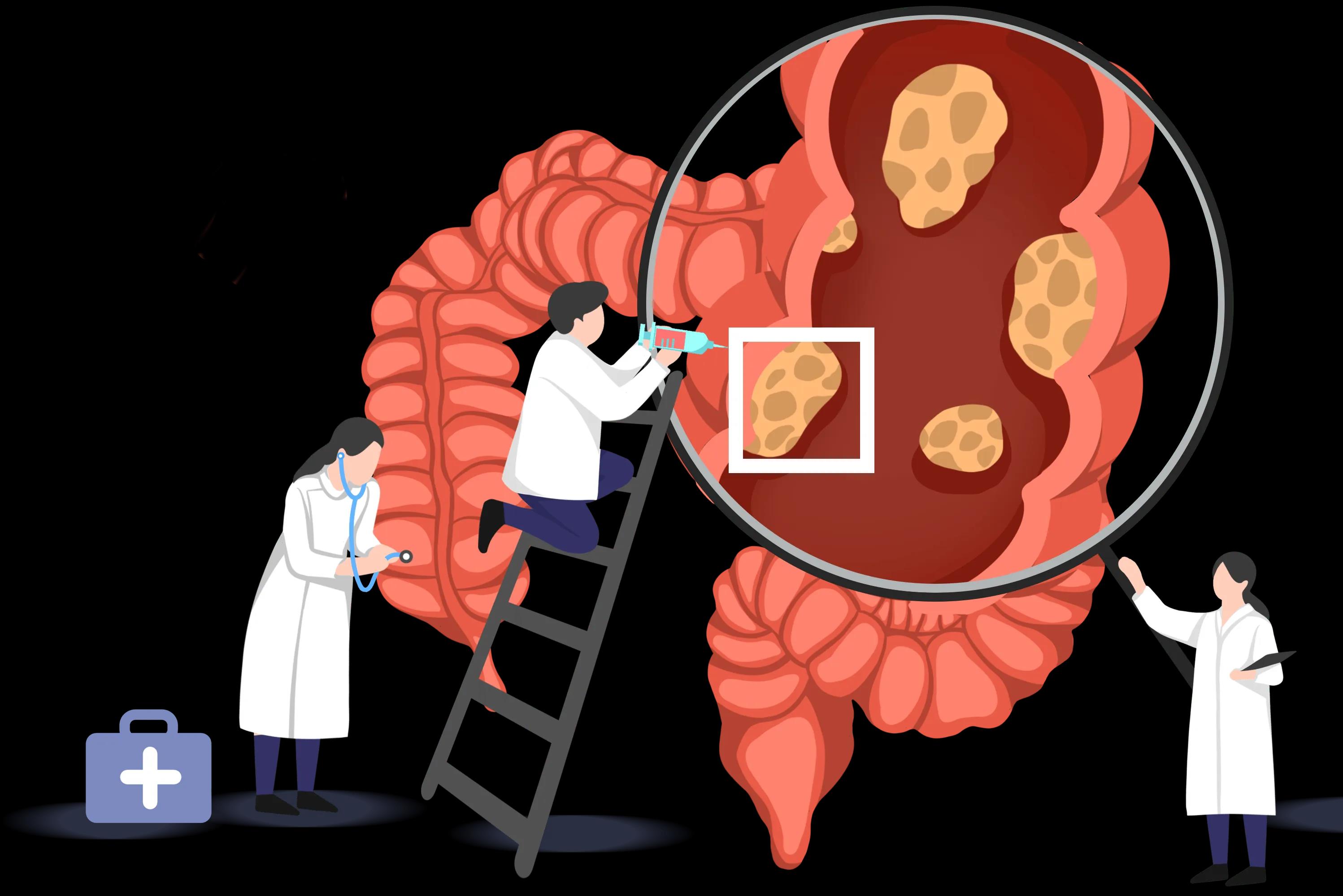 结直肠癌的诊断方法有哪些(图1) 微信图片_20220913151344.jpg