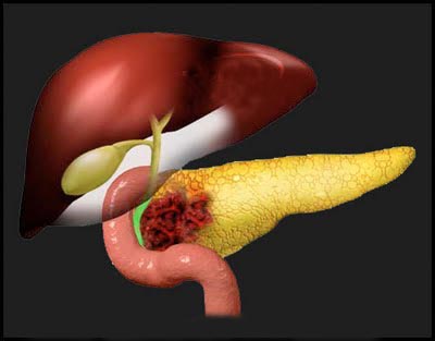 a28bcd6706323756d355e5d5d12d10ba.jpeg a28bcd6706323756d355e5d5d12d10ba.jpeg