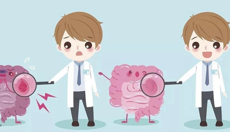 结肠癌怎样进行治疗?