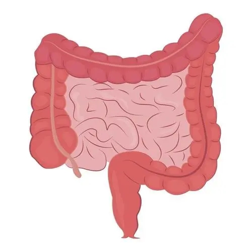 高热量食物诱发结肠癌
