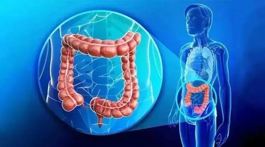 结肠癌的治疗原则是什么