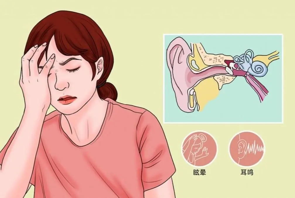 警惕！频繁耳鸣或是鼻咽癌的早期信号