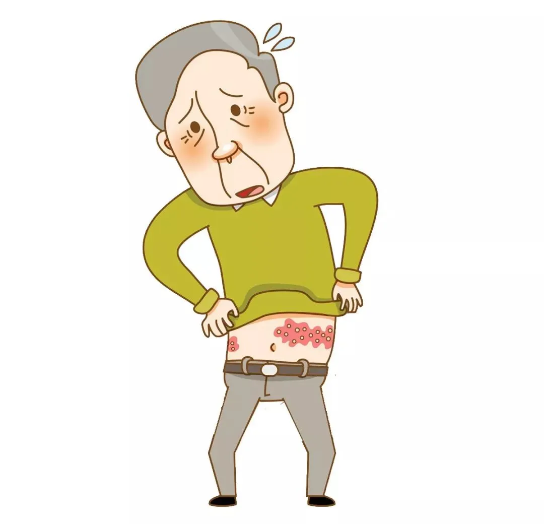 带状疱疹，老年人健康的“潜伏杀手”