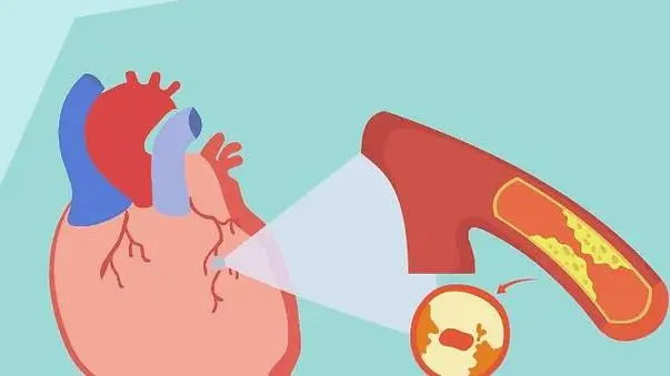 640 (1)_看图王.web.jpg