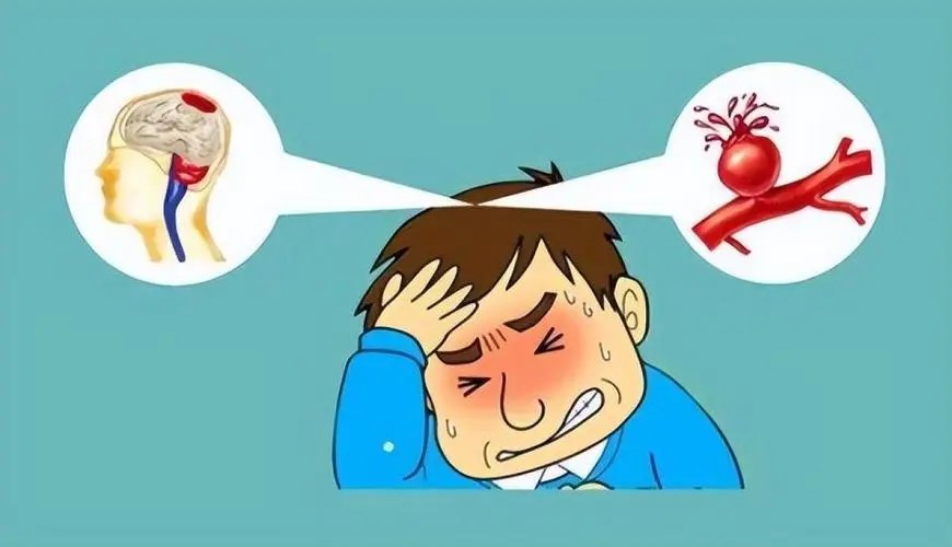 别小瞧头痛头晕,可能是脑血管在“报警”(图2) 640.jpg
