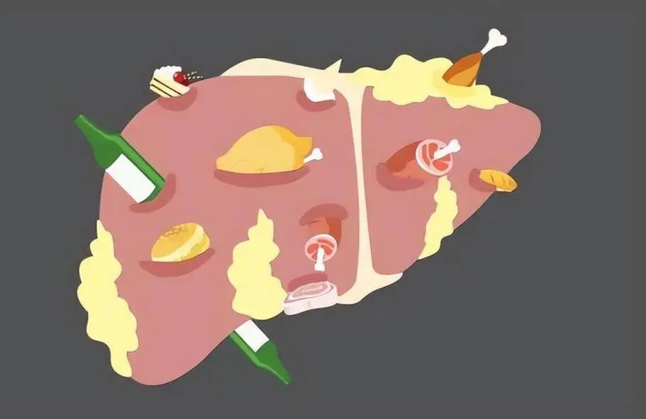 肝病年轻化:30 岁人群肝功能异常率暴涨 300%!(图3) 640 (1)_看图王.web(3).jpg