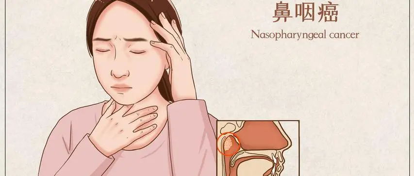 ‘鼻炎’还是‘鼻咽癌’？如何区分，一招教你识别！