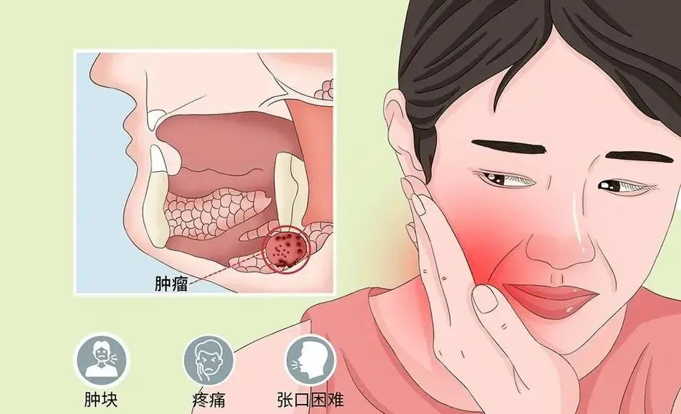 不抽烟不喝酒，为什么也会得口腔癌？