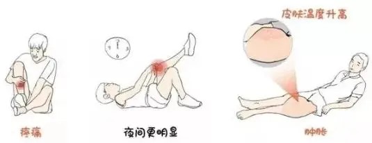 骨肉瘤:容易被误诊为 “生长痛” 的隐形杀手!(图3) 640 (3).jpg