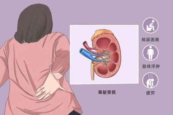 “尿毒症多是‘拖’出来的!医生:3个习惯正在毁掉你的肾!”(图5) 640 (22)_看图王.web.jpg