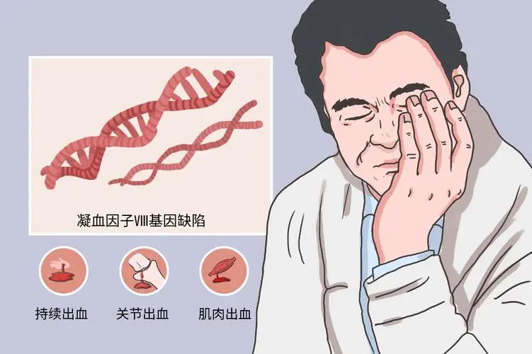 "轻轻磕碰就淤青不止?警惕这种‘玻璃人’的隐形危机" (图2) 640 (19)_看图王.web.jpg