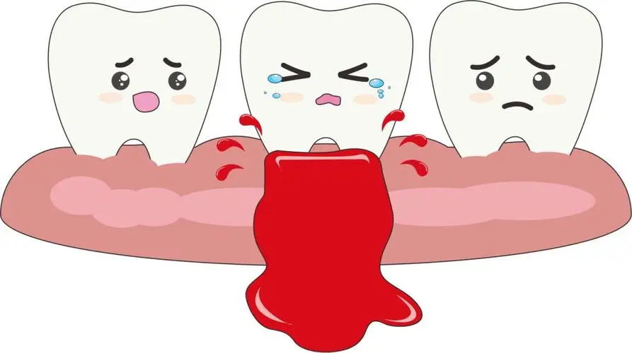 "轻轻磕碰就淤青不止?警惕这种‘玻璃人’的隐形危机" (图4) 640 (17)_看图王.web.jpg