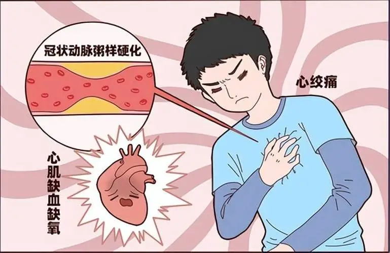 总是胸闷、气短?你可能被‘心肌缺血’盯上了!这些习惯赶紧改 (图2) 640 (2)_看图王.web.jpg