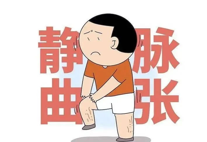 "腿上青筋凸起像树根？这可不是小事！医生警告：忽视可能烂腿！"