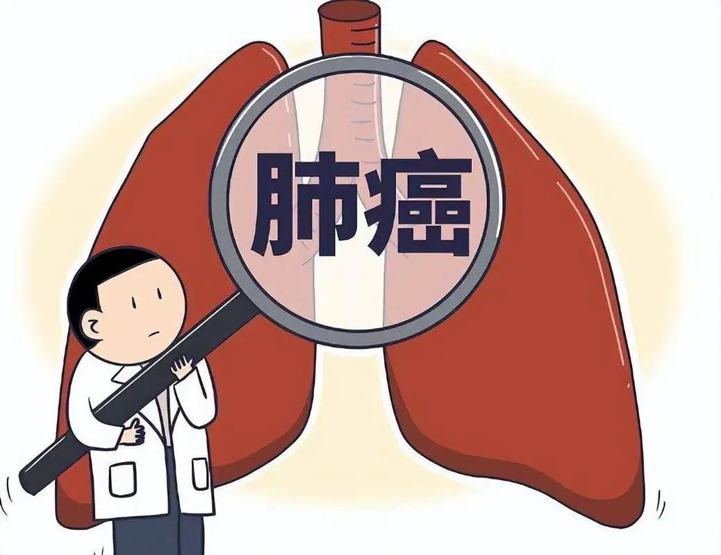 胸痛≠胃病!年轻人忽视的肺癌信号,有人拖到晚期才后悔