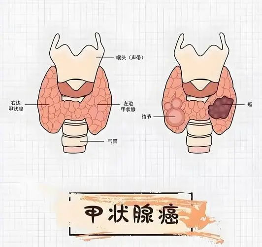 医生说我是“幸运的癌症患者”,真相让所有人沉默 (图3) 640 (6)_看图王.web.jpg