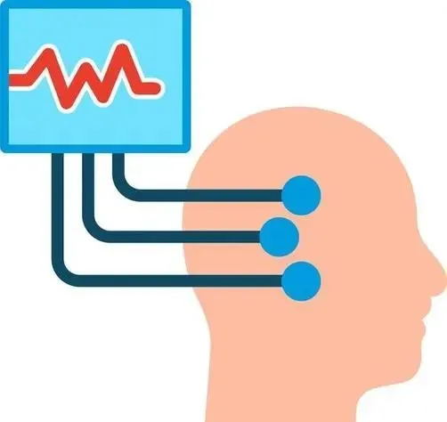 为什么有人一生只发作一次,有人却反复抽搐?癫痫的残酷差异(图4) 640 (15)_看图王.web.jpg