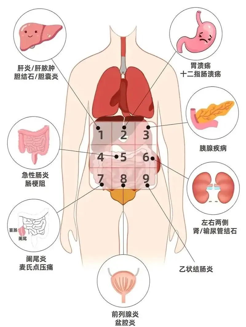 右下腹突然剧痛?可能是身体里的"定时炸弹"在报警!(图2) 640 (5)_看图王.web.jpg