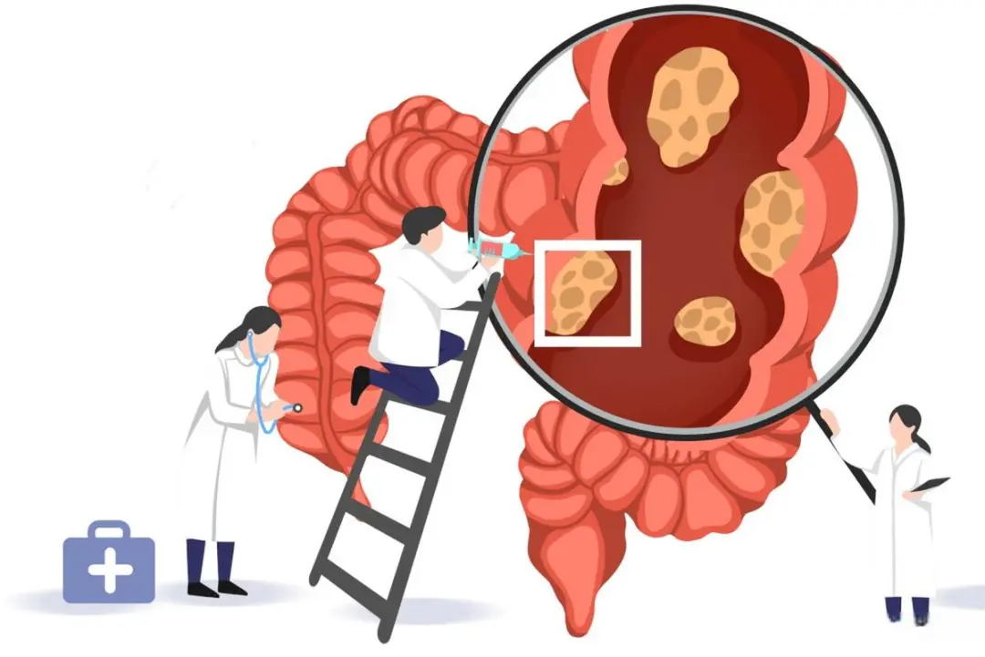 肠癌年轻化!熬夜、外卖、久坐…这些习惯正在毁掉你的肠道