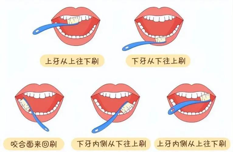 每天刷牙出血?你可能正在‘喂养’牙周炎细菌!(图4) 640 (9)(1).jpg