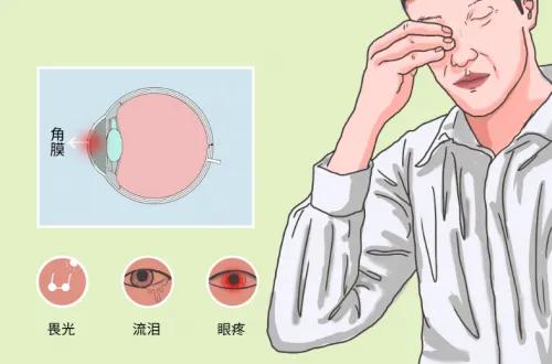 夏天最易被忽略的防晒死角:眼睛防晒,比你想的更重要!(图2) 640 (6)(1).jpg