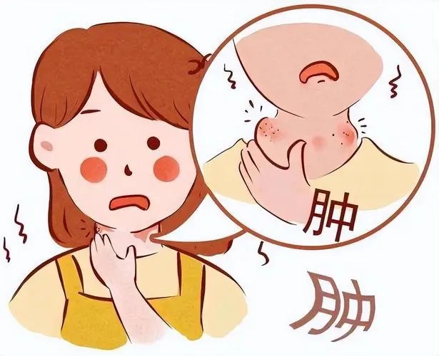 甲状腺癌早期不是脖子疼,而是身上6种异常(图2) 640 (31).jpg