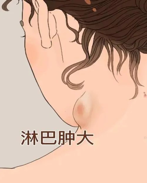 甲状腺癌早期不是脖子疼,而是身上6种异常(图5) 640 (28).jpg
