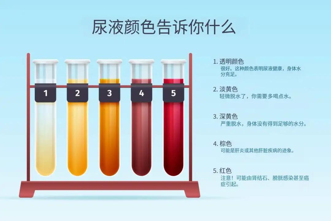 体内有癌,早晨知道!晨起有这5种表现,可能是癌症前兆(图5) 640 (16)(1).jpg