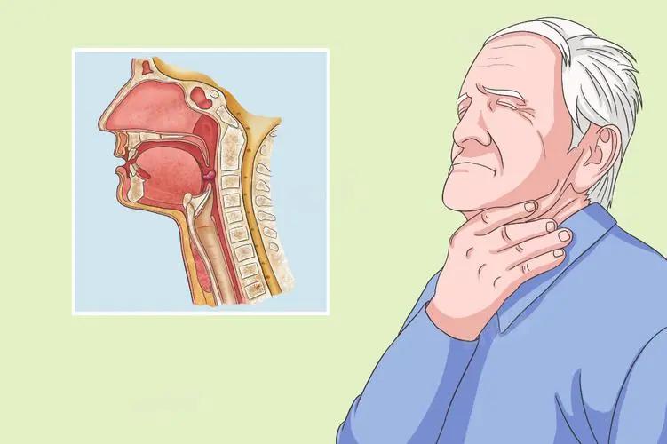 喉咙出现这三种症状别大意!可能是喉癌信号,别再当咽炎拖了(图3) 640 (13)(1).jpg