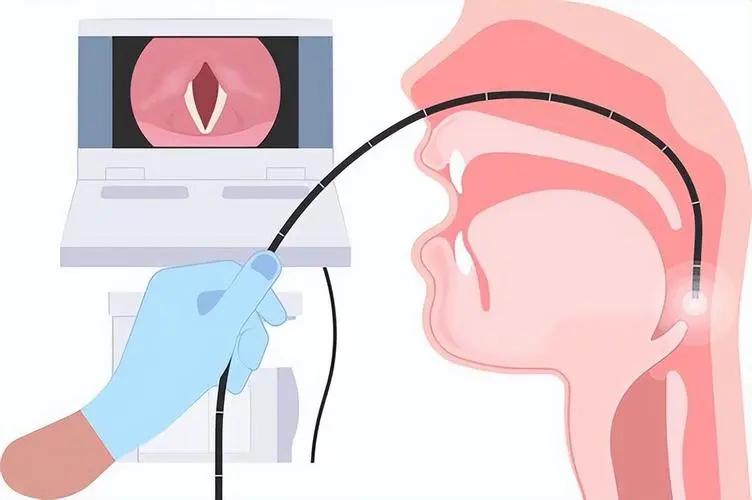 喉咙出现这三种症状别大意!可能是喉癌信号,别再当咽炎拖了(图6) 640 (10)(1).jpg