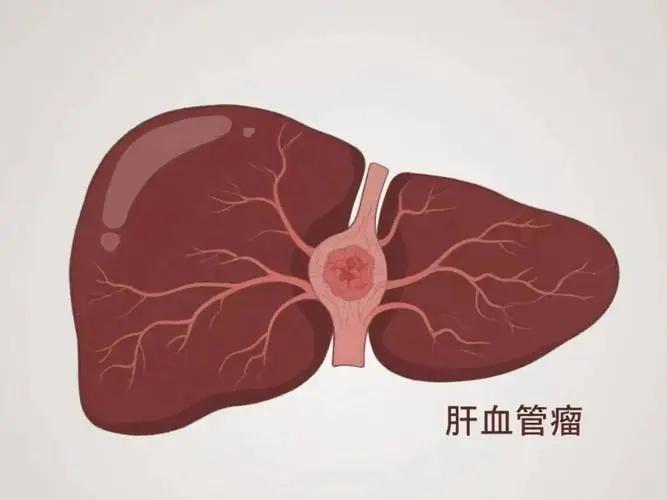 体检报告出现这几个字,距离癌症可能只有“一步之遥”!(图5) 640 (7)(1).jpg