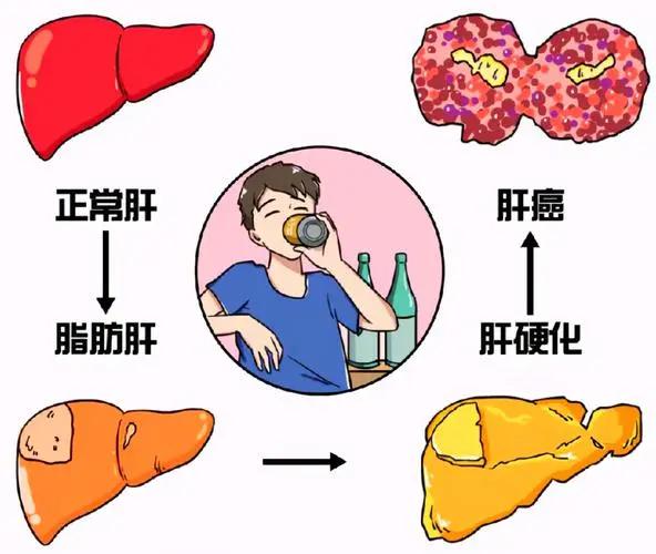 体检报告上“脂肪肝”三个字,别以为不痛不痒就没关系!(图3) 640 (4)(1).jpg