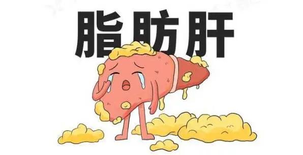 体检报告上“脂肪肝”三个字,别以为不痛不痒就没关系!