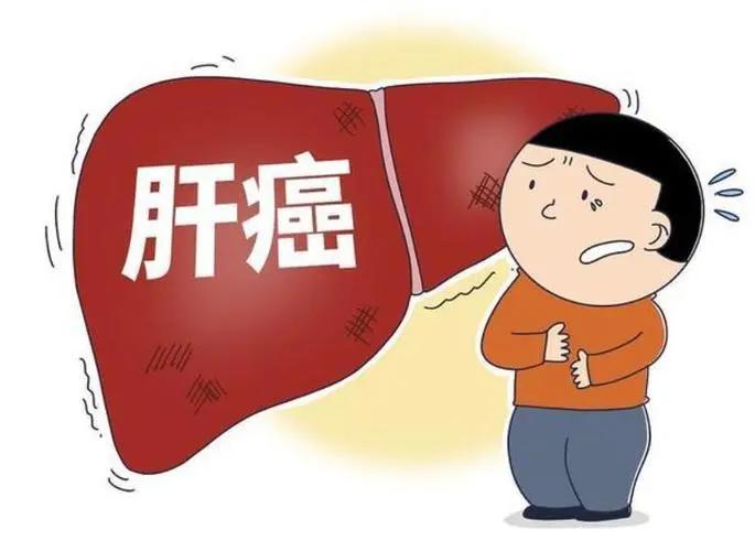 肝癌发生前1年,身体可能出现的4种“预警信号”,别忽视!
