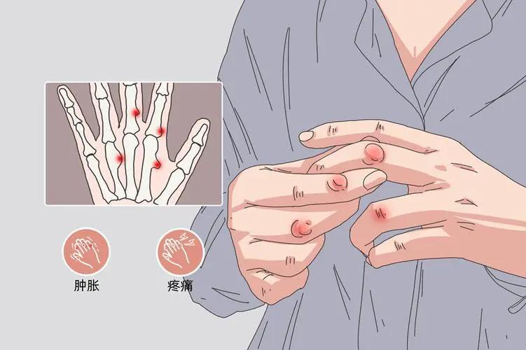 骨头也会得癌?身体出现这些“不对劲”,赶紧去查查!(图3) 640 (7)(1).jpg