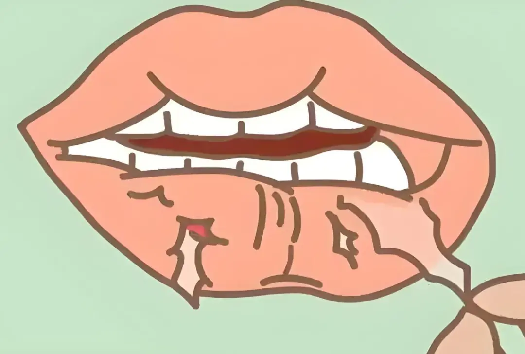 嘴唇干裂起皮？别只怪缺水！这5个隐藏原因才是关键